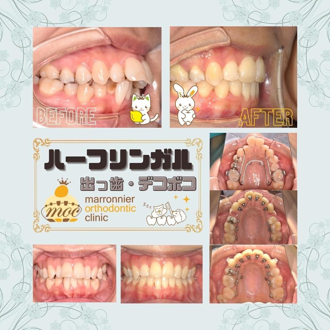 症例
