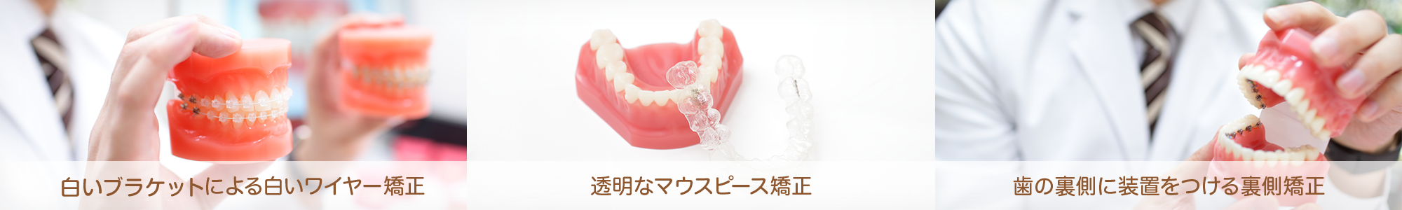 白いブラケットによる白いワイヤー矯正 透明なマウスピース矯正 歯の裏側に装置をつける裏側矯正