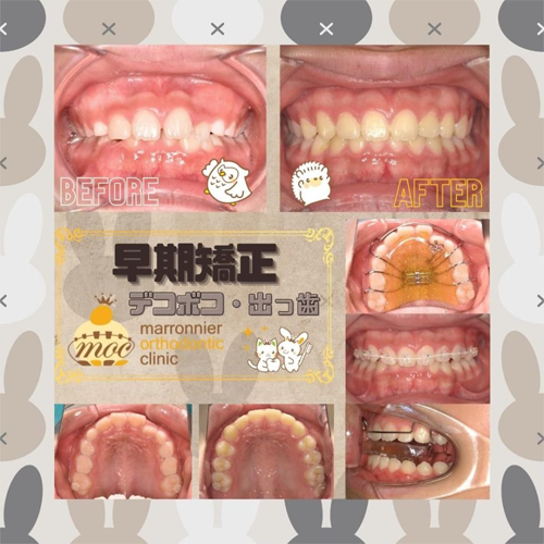 症例
