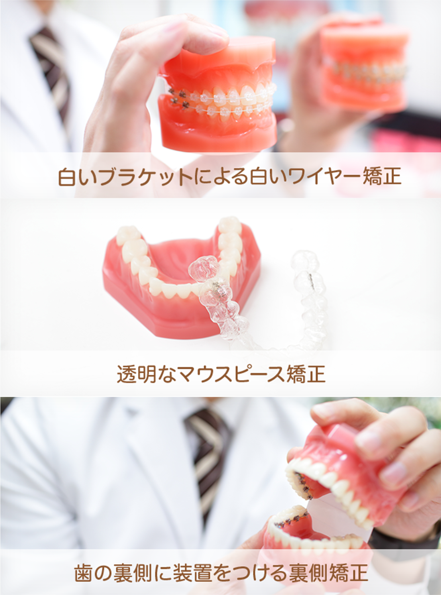 白いブラケットによる白いワイヤー矯正 透明なマウスピース矯正 歯の裏側に装置をつける裏側矯正