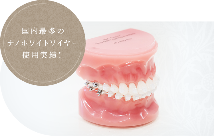 国内最多のナノホワイトワイヤー使用実績！