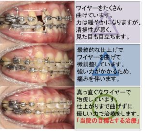 痛みが少ない矯正治療 マロニエ矯正歯科クリニック